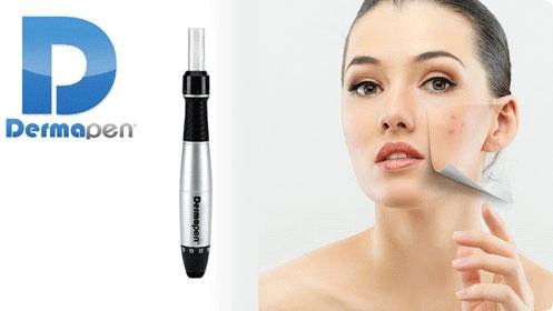 Higiene Facial +Mesoterapia Dermapen con vitaminas